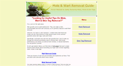 Desktop Screenshot of mole-wart-removal-guide.com