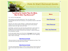 Tablet Screenshot of mole-wart-removal-guide.com